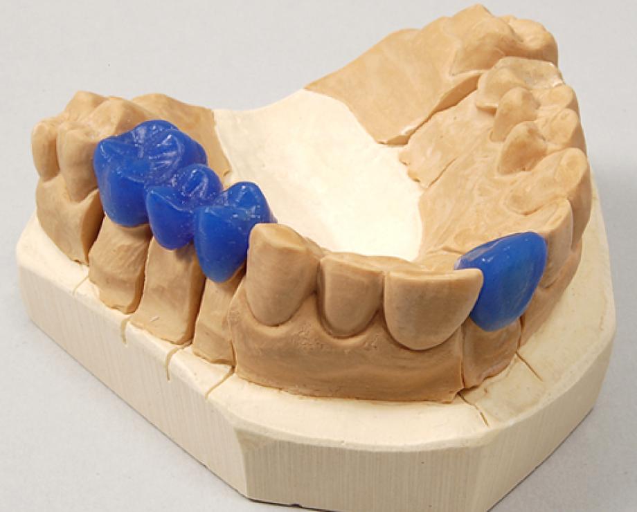 Dentale