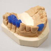 Dentale