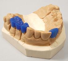 Dentale 3